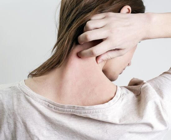 Image of a woman itching the back of her neck because she has no water softener