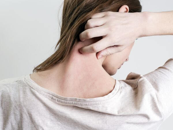 Image of a woman itching the back of her neck because she has no water softener