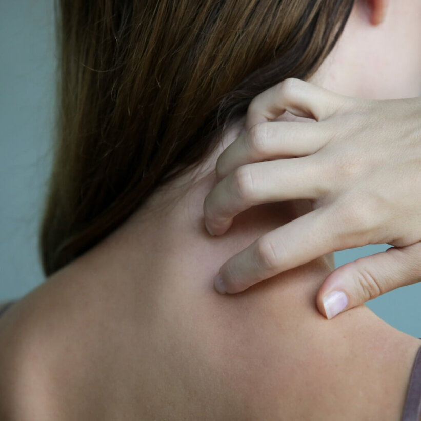 Why Do I Have Itchy Skin After I Shower? Angel Water