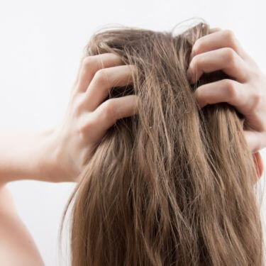 Woman with a dry, itchy scalp and brittle hair from hard water